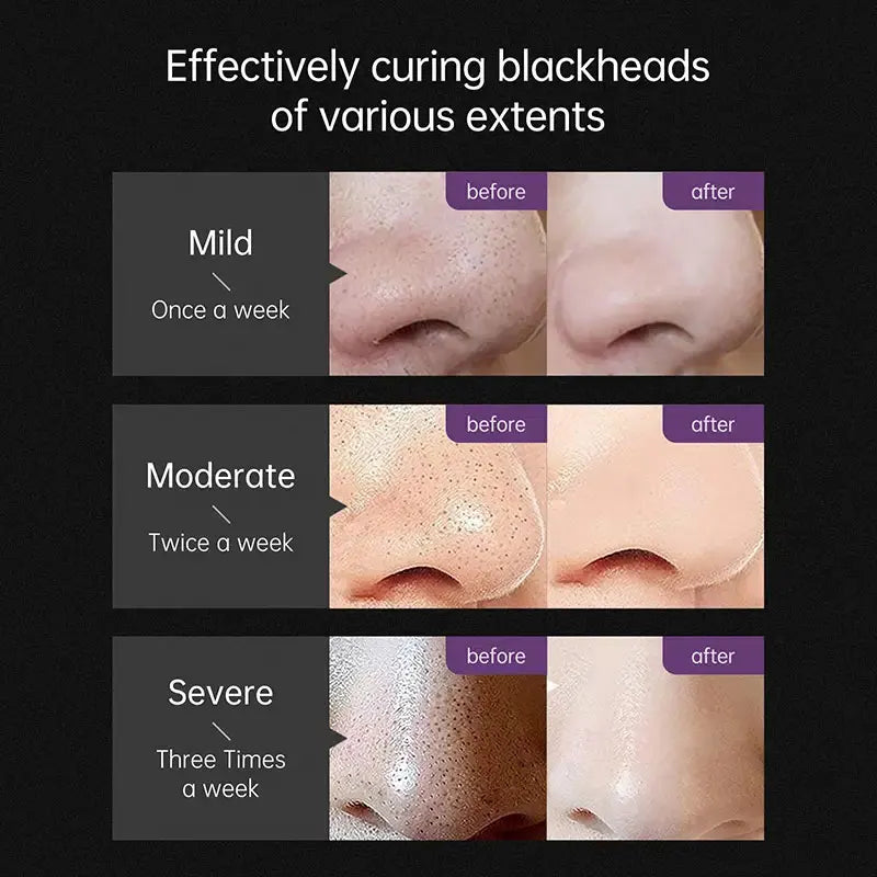 Masque facial au charbon de bambou